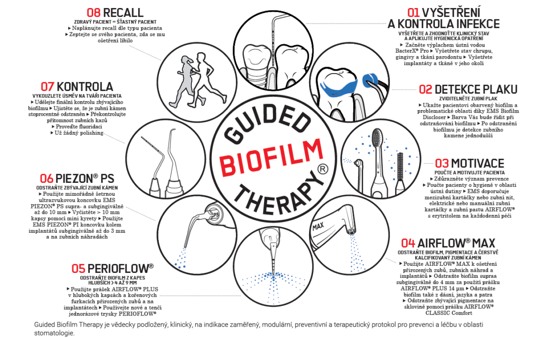 Metoda „Guided Biofilm Therapy“ je mezi pacienty nejoblíbenější